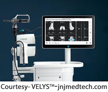 VELYS Robotic-Assisted Solution for Knee Replacement